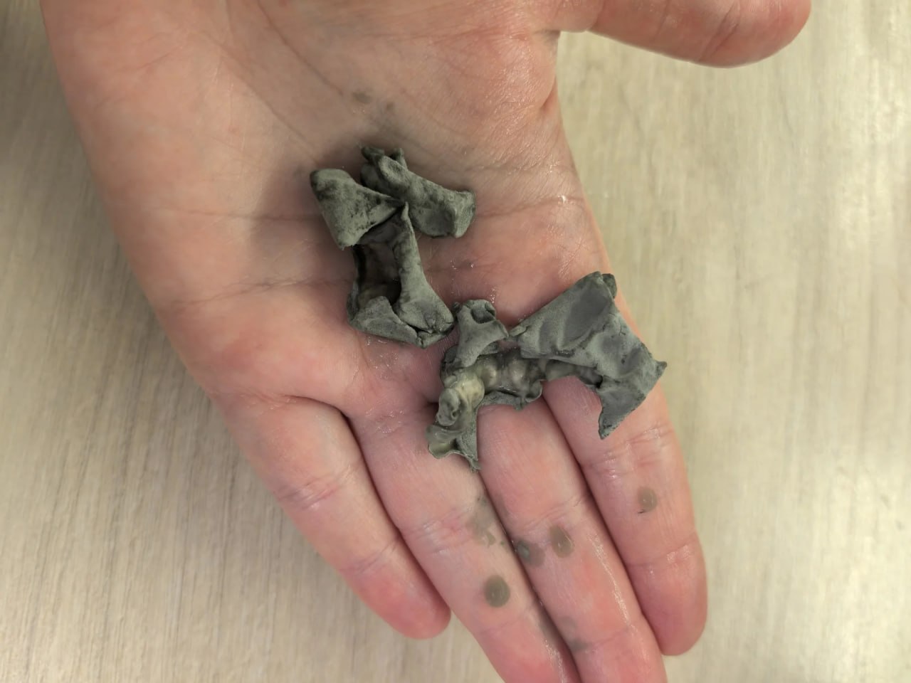 Тошнота, диарея и высыпания: тульский школьник попал в больницу после пачки сока